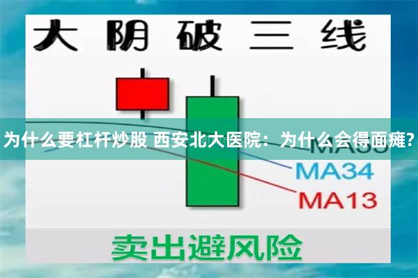 为什么要杠杆炒股 西安北大医院：为什么会得面瘫?